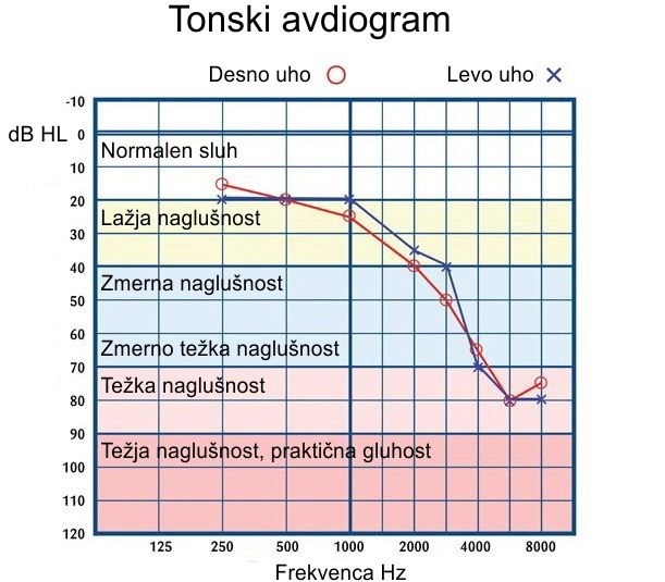 Pražna tonska avdiometrija