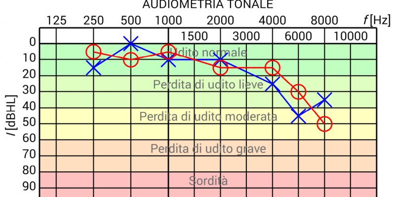 audiogramma tonale