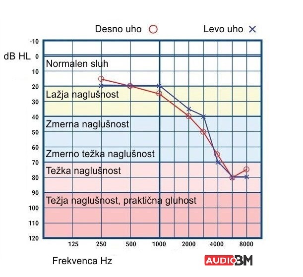 Avdiogram_Audiogram