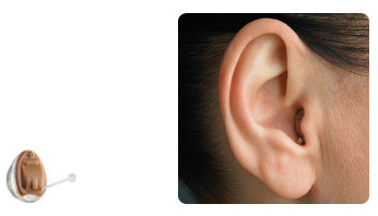 Completely-In-Canal-cic-hearing-aids-how-it-looks-unitron-sonic-hearing-aids-audio-bm-hearing-centers